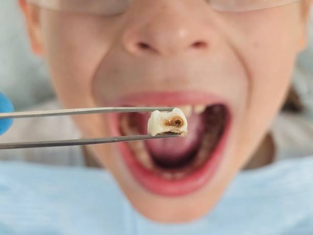 Best Emergency Dental Care for Trauma or Injury in Benjamin, UT